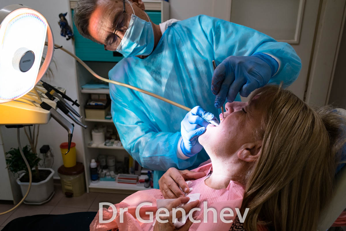 Dott Genchev placing a  basal dental implant